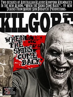 Kilgore - When The Skins Come Back (2026)